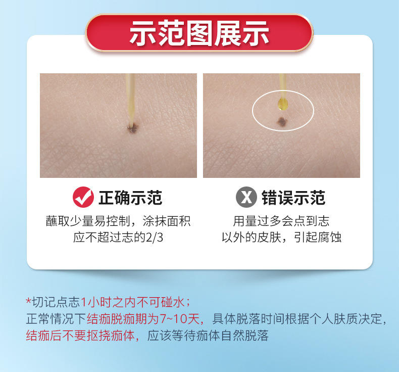 新款南京同仁堂志净净去痣点痣膏无痕非药水祛点斑点痣