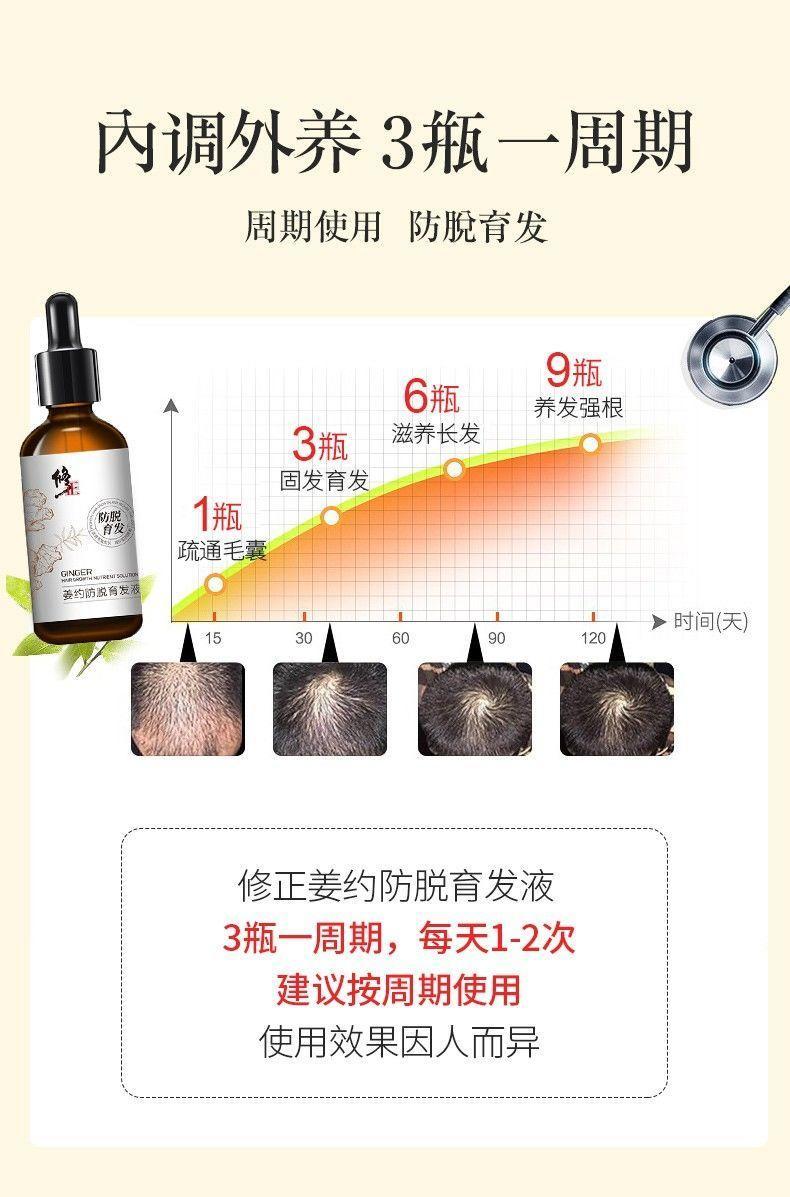 修正姜约防脱育发液